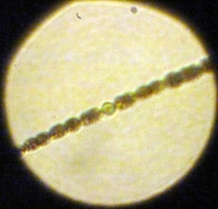 anabena03